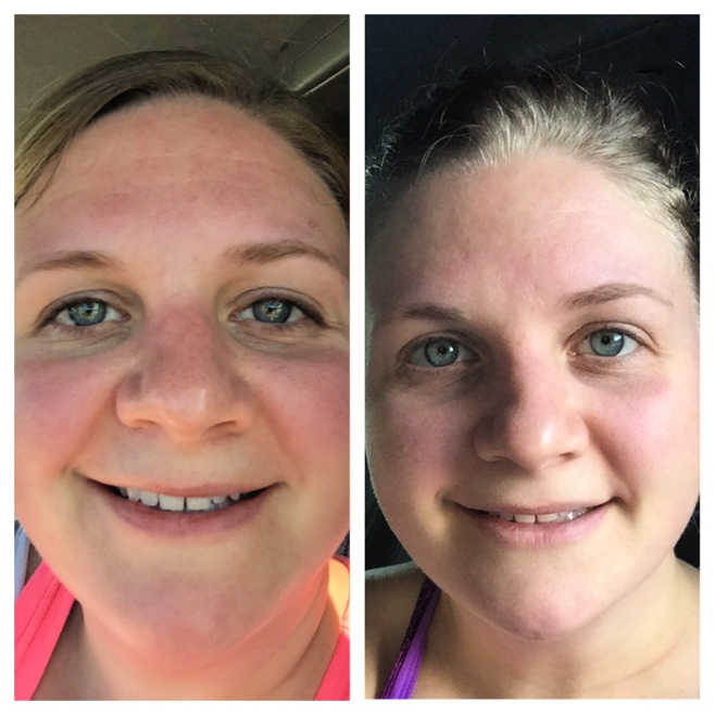 Client Transformations: Before and After Pictures